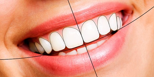 These 10 Hacks Will Make Your composite fillings Look Like A Pro